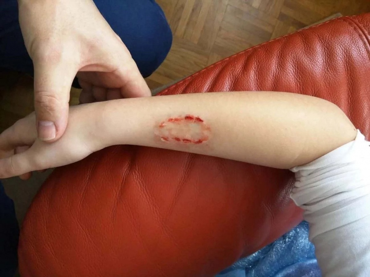 is puppy bite infectious